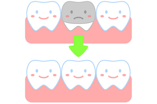 実は危ない銀歯のリスクとは？セラミックとの違いも解説